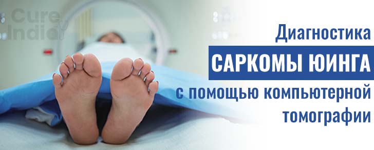 Диагностика саркомы Юинга с помощью компьютерной томографии